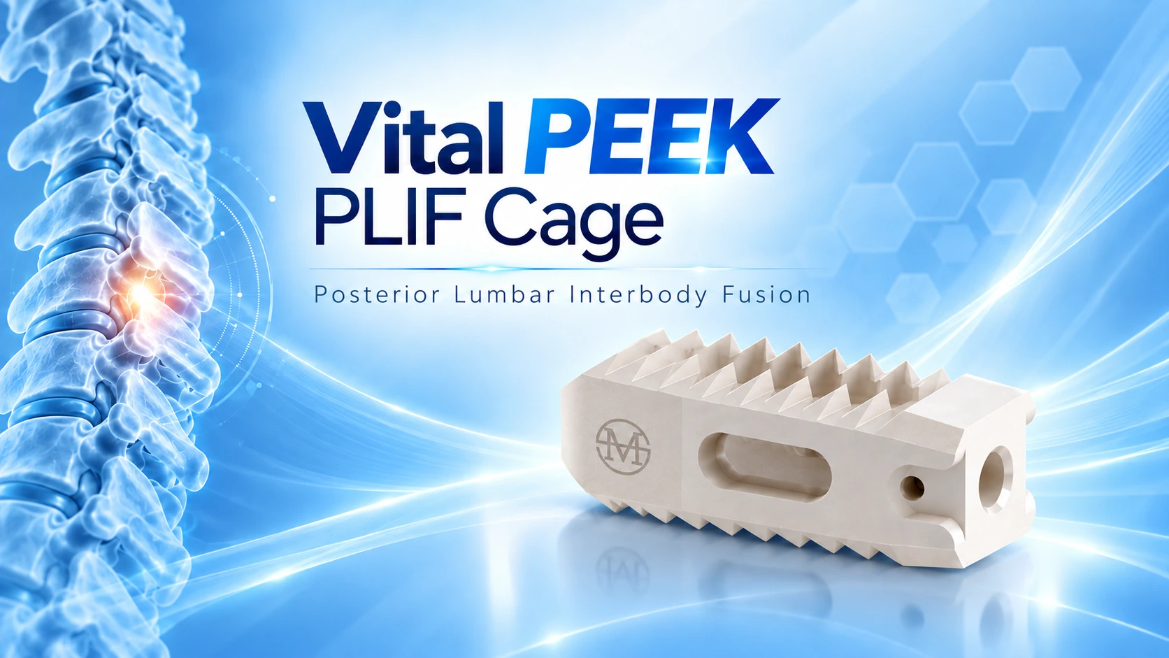 Vital PEEK PLIF Cage
